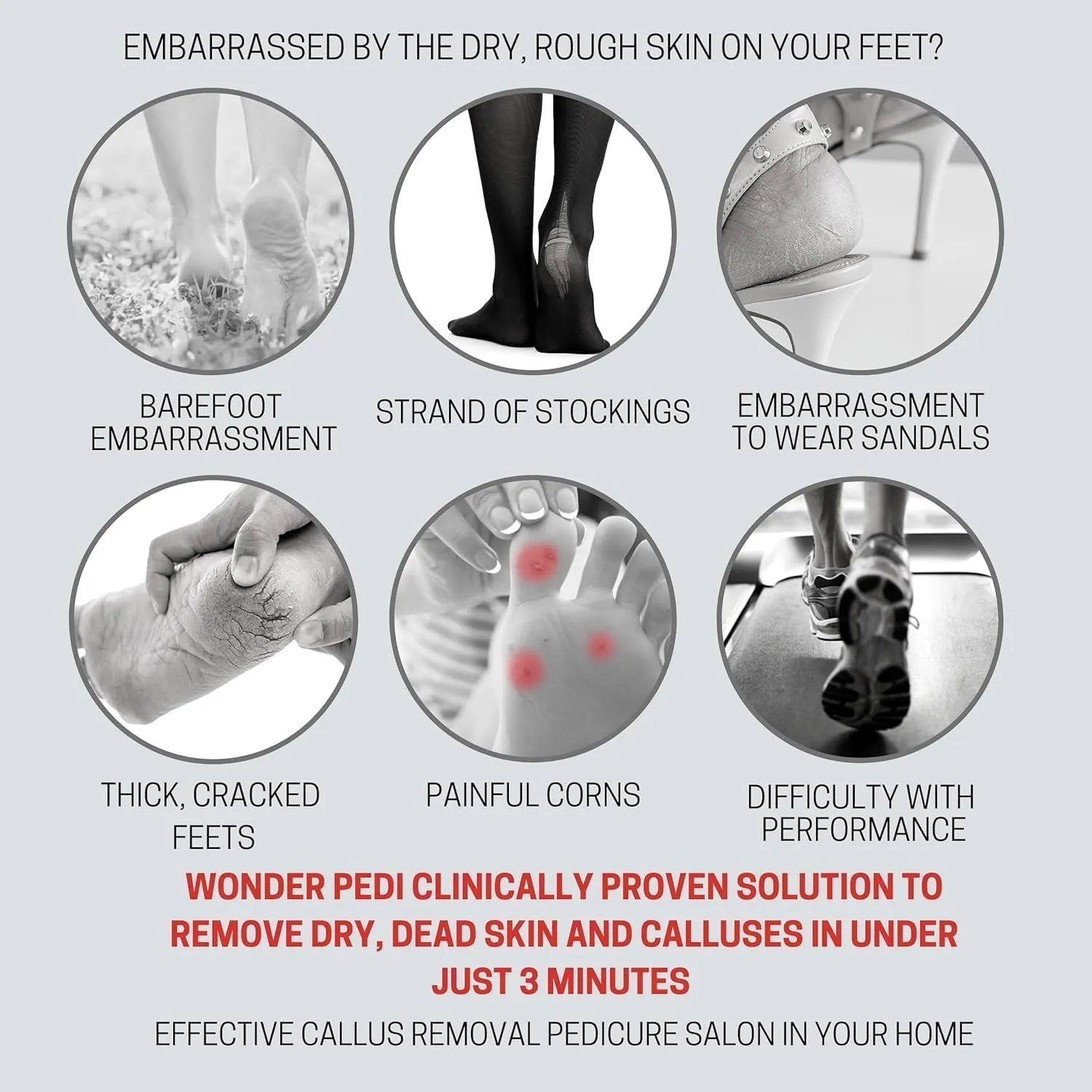Callus Remover, Instant Exfoliating Foot Peel Spray, Feet Dead Skin Cracked Heels Softener Pedicure Treatment Works with Any Foot File. Wonder Pedi (200ML)